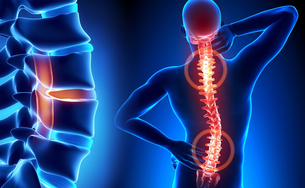 TỔN THƯƠNG TỦY SỐNG