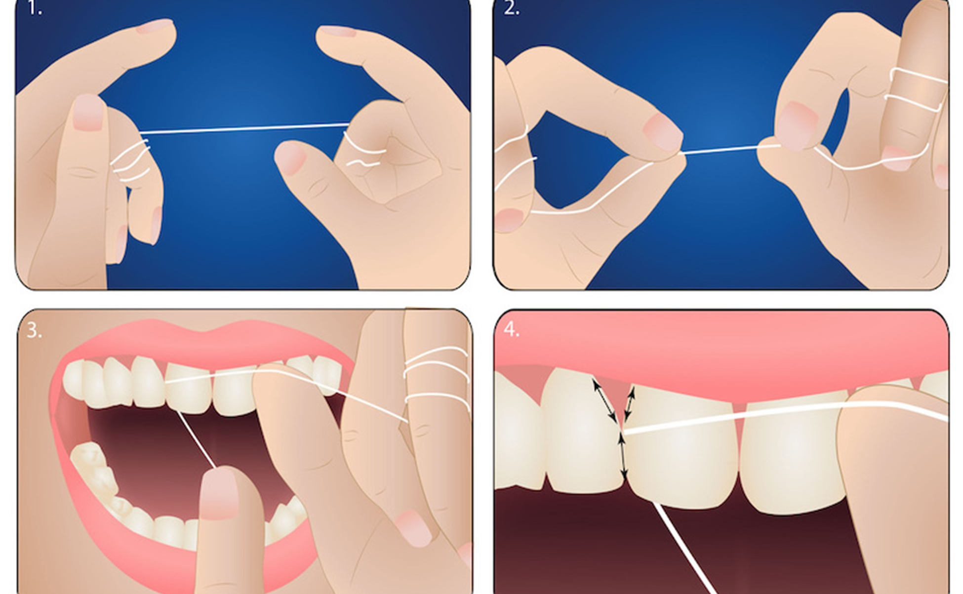 Sử dụng chỉ nha khoa đúng cách