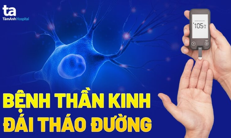 Hướng dẫn chẩn đoán và điều trị bệnh Thần kinh đái tháo đường
