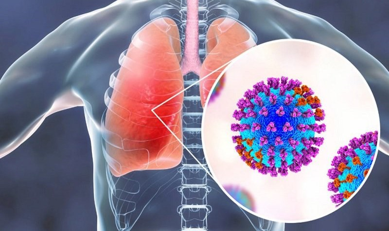 CHỦ ĐỘNG PHÒNG CHỐNG VIRUS RSV CHO TRẺ