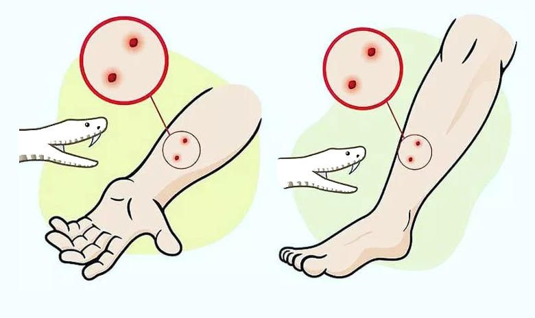 Hướng dẫn mới của WHO về điều trị rắn cắn mới đã được công bố