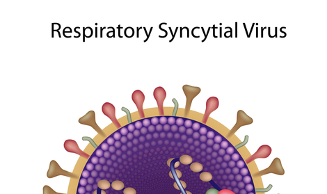 Bàn luận về vai trò của kháng thể đơn dòng trong  dự phòng nhiễm virus hợp bào hô hấp RSV