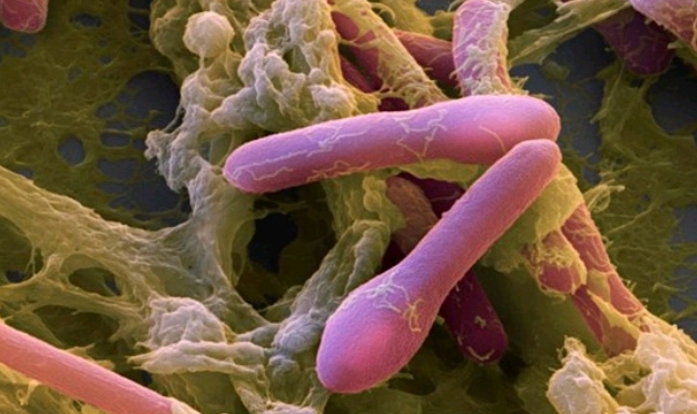 NGỘ ĐỘC BOTULINUM: TỔNG QUAN CƠ CHẾ BỆNH SINH, LÂM SÀNG VÀ XỬ TRÍ