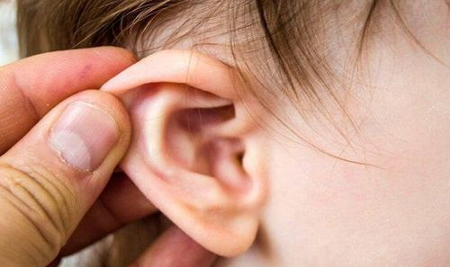 VIÊM TAI GIỮA CẤP