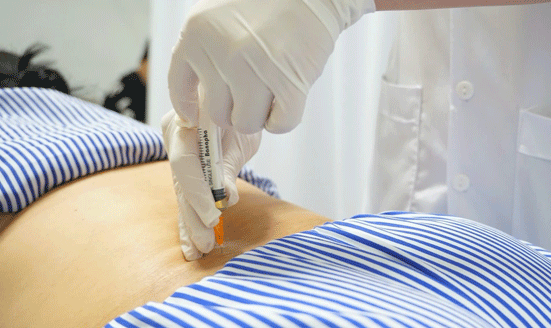 THỦY CHÂM TRONG Y HỌC CỔ TRUYỀN –  KẾT HỢP TINH HOA Y HỌC CỔ TRUYỀN  VỚI Y HỌC HIỆN ĐẠI