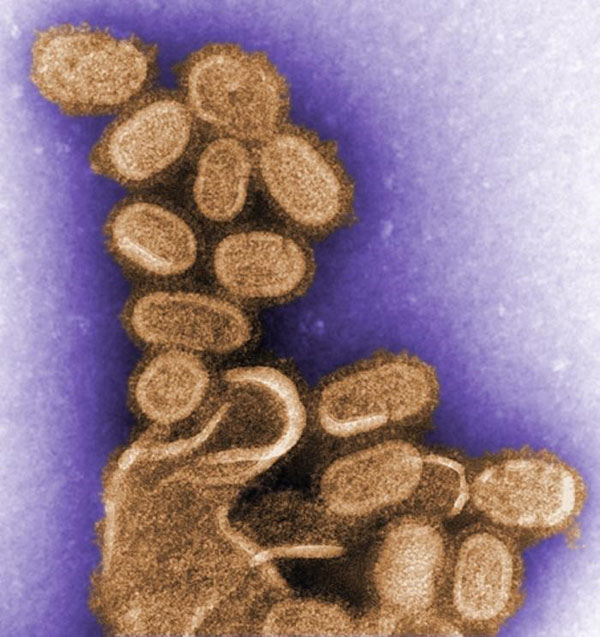 Đại dịch cúm chết người năm 1918 có thể là nguồn gốc của virus theo mùa nhẹ hơn hiện nay