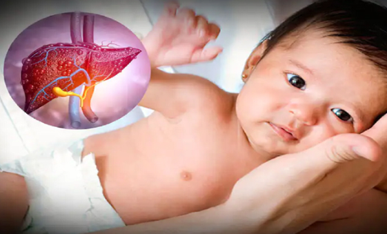 Bệnh viêm gan cấp chưa rõ nguyên nhân ở trẻ em