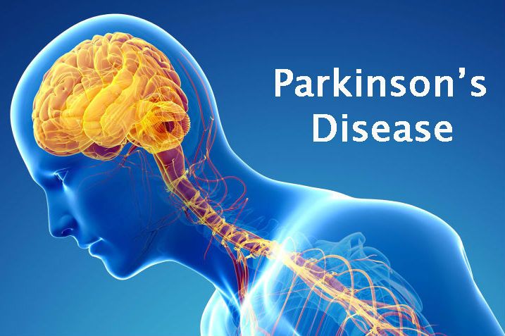 Hóa chất được sử dụng rộng rãi liên quan chặt chẽ đến bệnh Parkinson